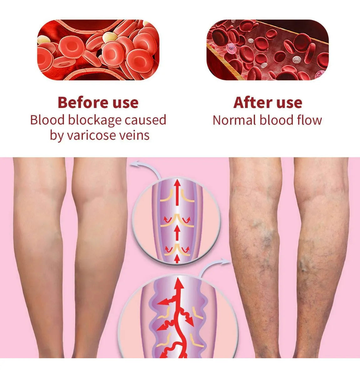 South Moon – Crema Refrescante para Piernas Cansadas