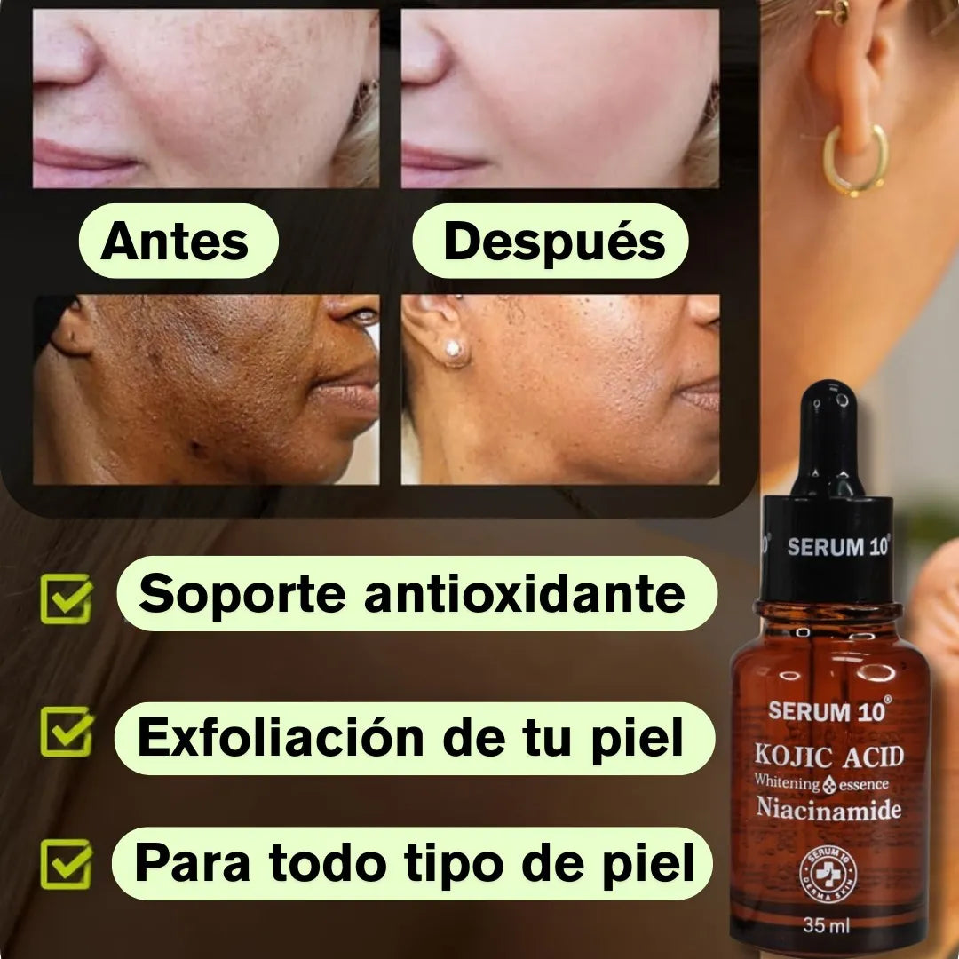 Serum 10 ACID KOJIC