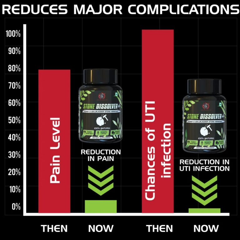 Stone Dissolver+ – Suplemento Natural de Bienestar Renal