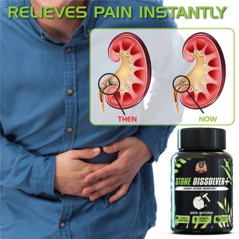 Stone Dissolver+ – Suplemento Natural de Bienestar Renal