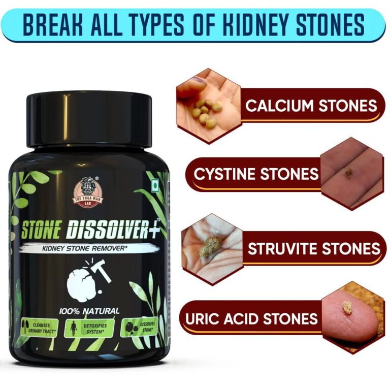 Stone Dissolver+ – Suplemento Natural de Bienestar Renal