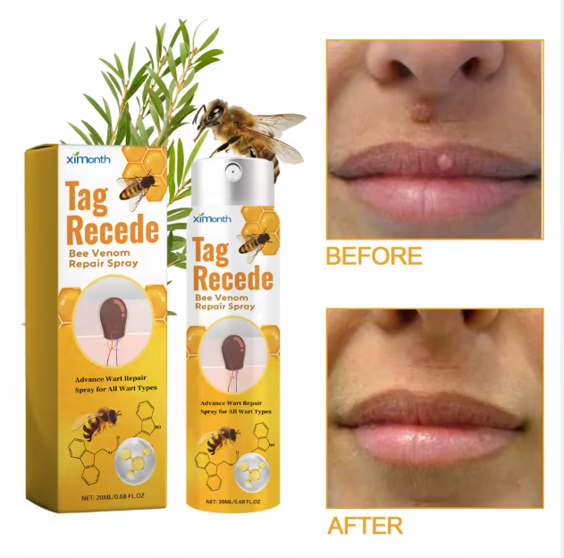 Tag Recede – Bee Venom Treatment Spray (60 ml)